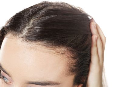 Anlagebedingter Haarausfall Frauen